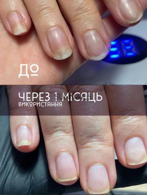 Eco Grit &laquo;G-tincture&raquo; Nail stimulate, 15 мл &mdash; відновлююча олійка від оніхолізису, 15 мл