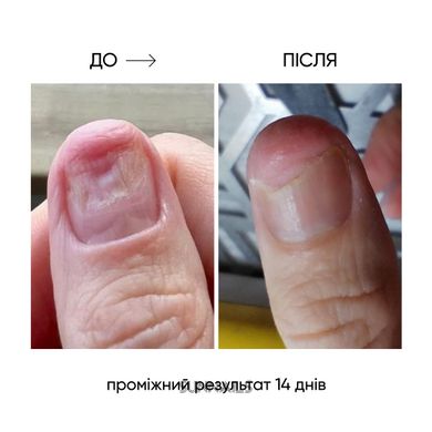 NAILSOFTHEDAY Onistop, 15 мл — регенеруюча олія проти оніхолізису