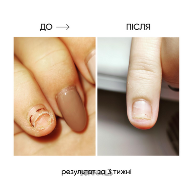 NAILSOFTHEDAY Onistop, 15 мл — регенеруюча олія проти оніхолізису