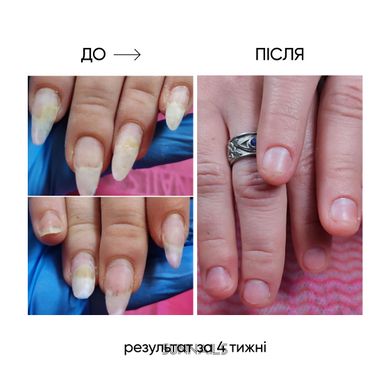 NAILSOFTHEDAY Onistop, 15 мл — регенеруюча олія проти оніхолізису