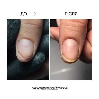 NAILSOFTHEDAY Onistop, 15 мл — регенеруюча олія проти оніхолізису