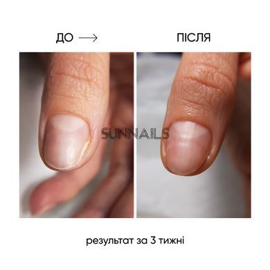 NAILSOFTHEDAY Onistop, 15 мл &mdash; регенеруюча олія проти оніхолізису