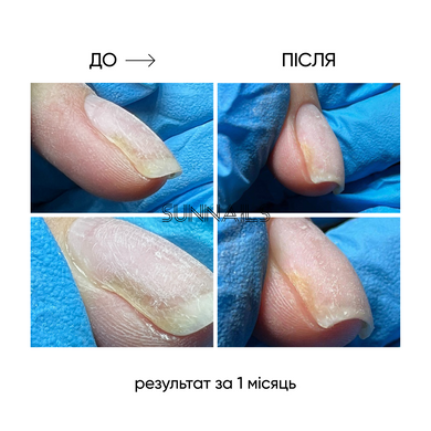 NAILSOFTHEDAY Onistop, 15 мл &mdash; регенеруюча олія проти оніхолізису