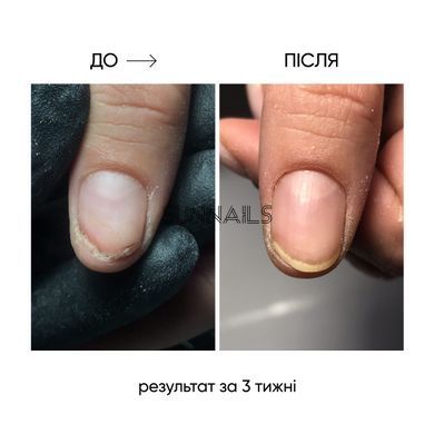 NAILSOFTHEDAY Onistop, 8 мл &mdash; регенеруюча олія проти оніхолізису