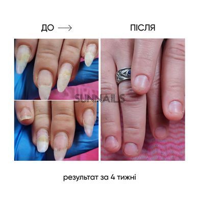 NAILSOFTHEDAY Onistop, 8 мл &mdash; регенеруюча олія проти оніхолізису