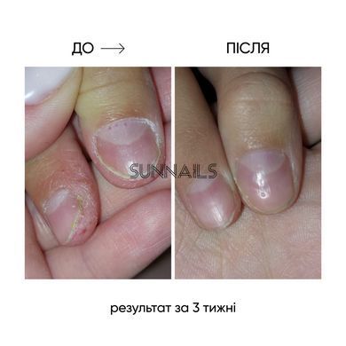 NAILSOFTHEDAY Onistop, 8 мл &mdash; регенеруюча олія проти оніхолізису