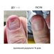 NAILSOFTHEDAY Onistop, 8 мл — регенеруюча олія проти оніхолізису