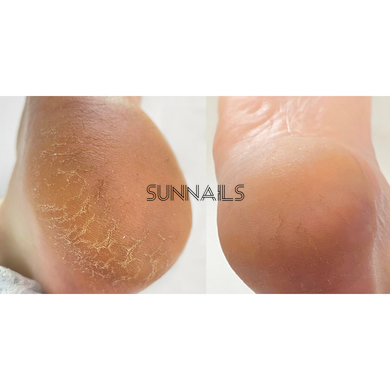 Nailsoftheday Podology+ КРЕМ від тріщин, заживлює тріщини на шкірі рук та стоп, 30 мл